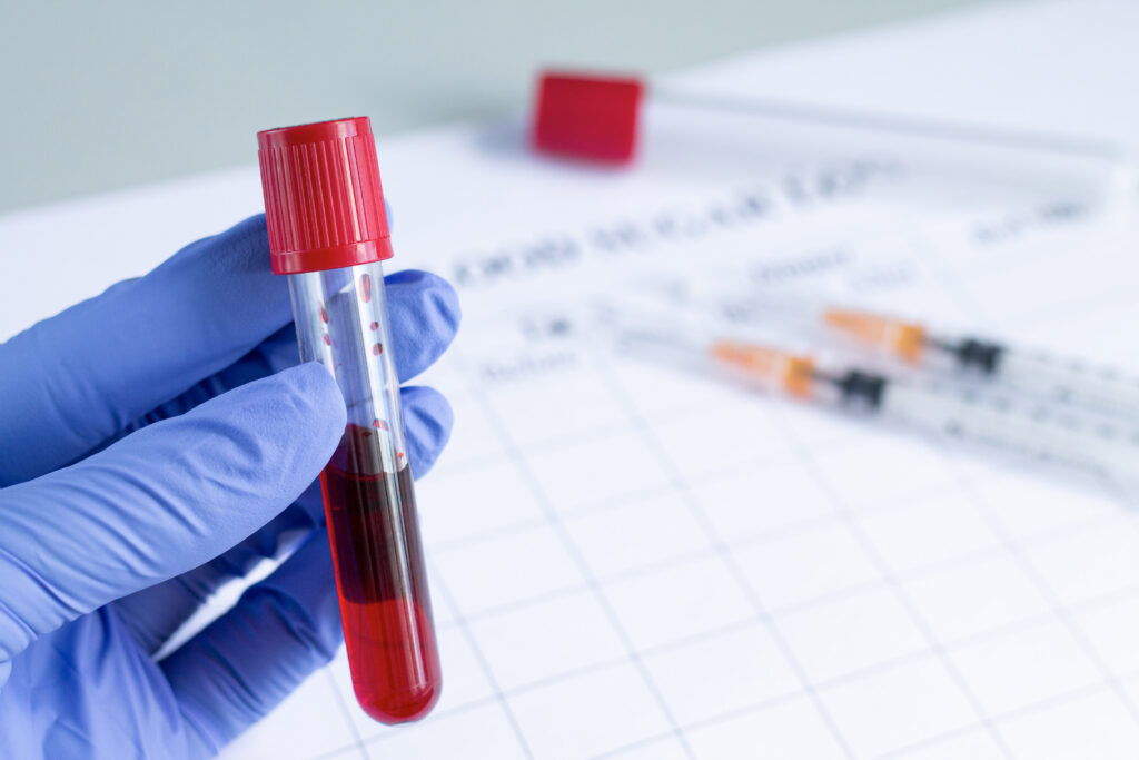 Ruka-doktora-drzi-krvny-test